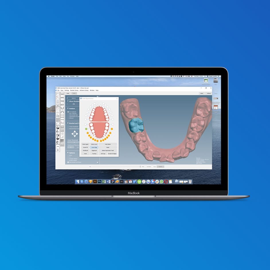 Orthoselect AI Integration