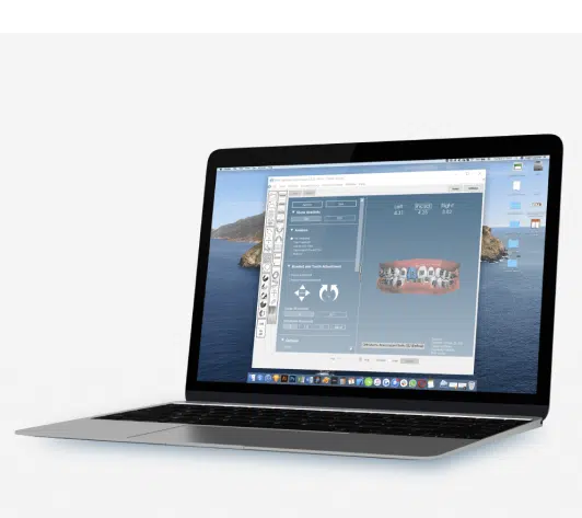 Orthoselect Portfolio Image