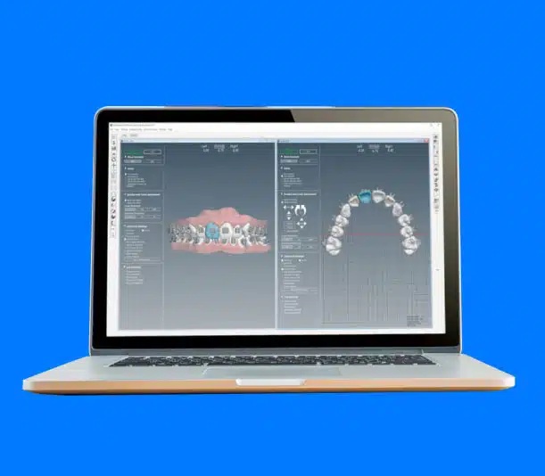 OrthoSeletect Portfolio Image